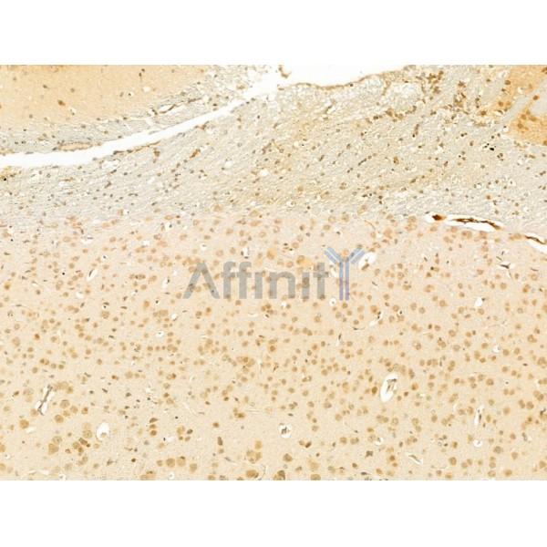 Валидация Affinity DF13749 - 9404