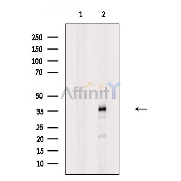 Валидация Affinity DF2453 - 13078