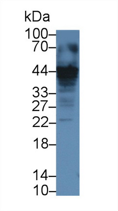 13641