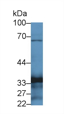 14187