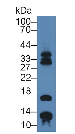12574