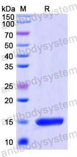 Валидация SDS-PAGE - AntibodySystem RHD01801
