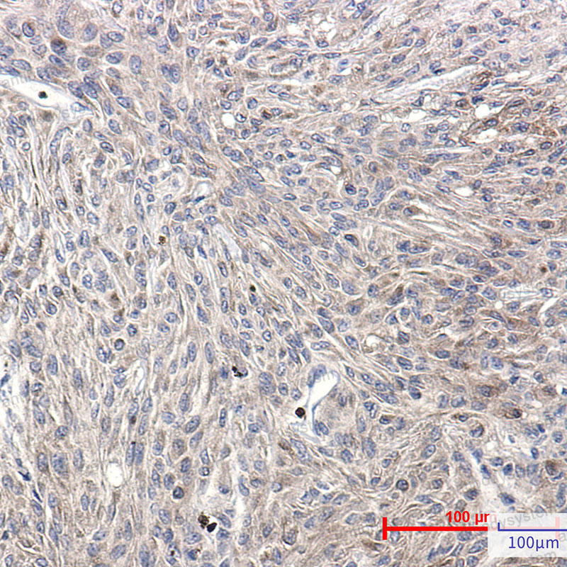 Валидация AntibodySystem RHD23207