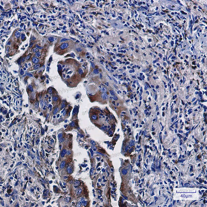 Валидация AntibodySystem RHC97402