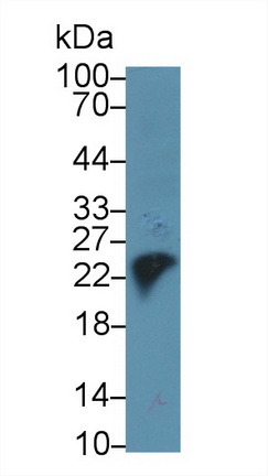 18415