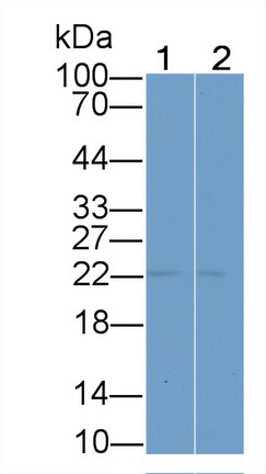 21381