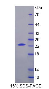 60315