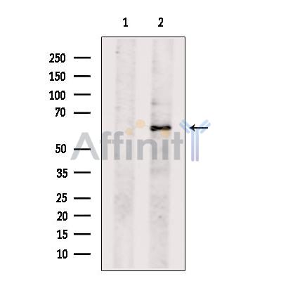 Валидация Affinity DF13283 - 8398