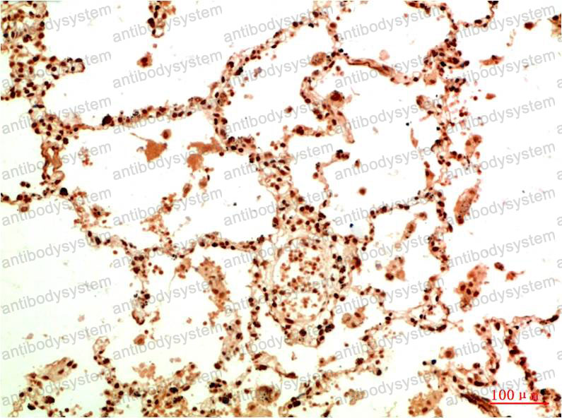 Валидация AntibodySystem RHG01004