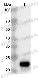 Валидация AntibodySystem PHB26201