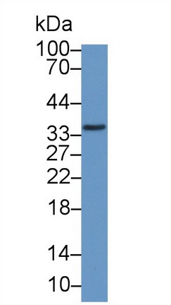 14170
