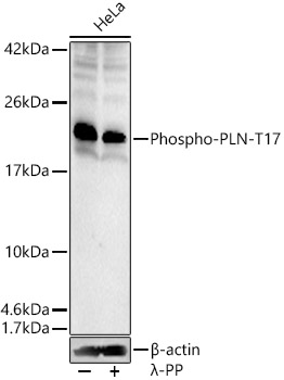 AP0910, вестерн-блоттинг, лизат клеток HeLa (27873)
