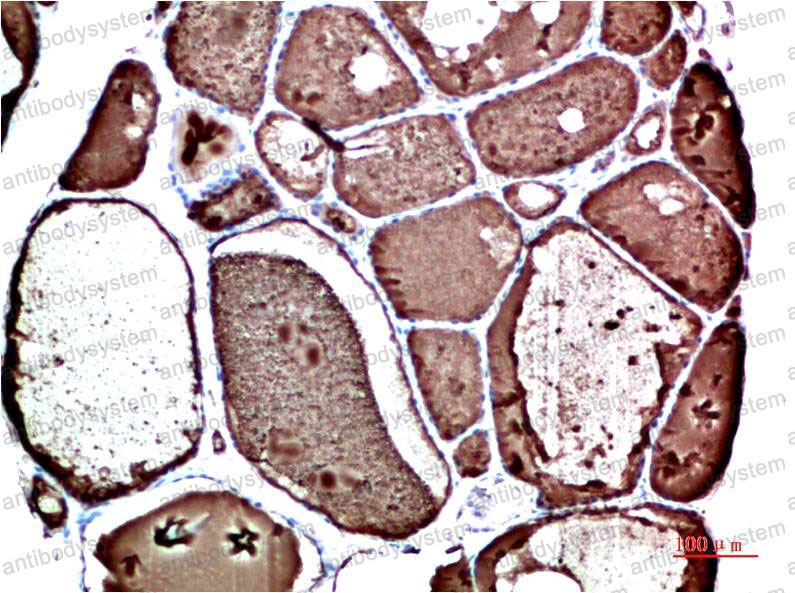 Валидация AntibodySystem RHC01307