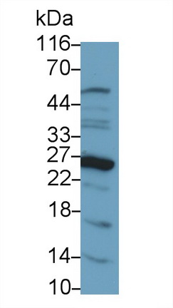 39261