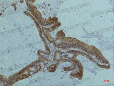 Валидация AntibodySystem RHF75509 (2661)