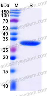 YHC83602, SDS-PAGE