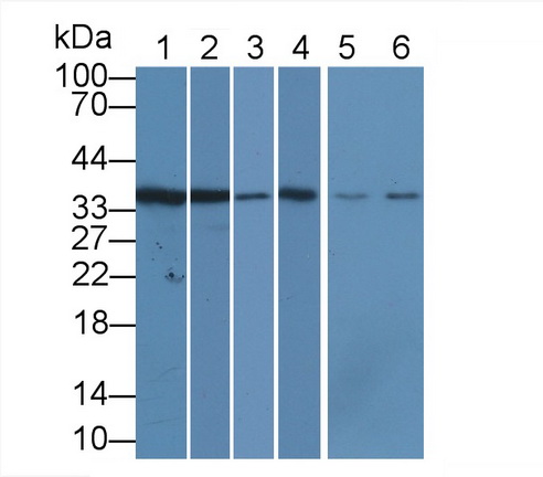 23885