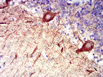 Валидация AntibodySystem RHA04901