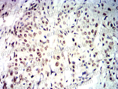Валидация AntibodySystem RHJ45303 (3424)