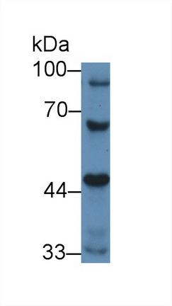 12761