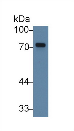 10170