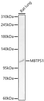 A16243, вестерн-блоттинг, лизат ткани легкого крысы (6504)