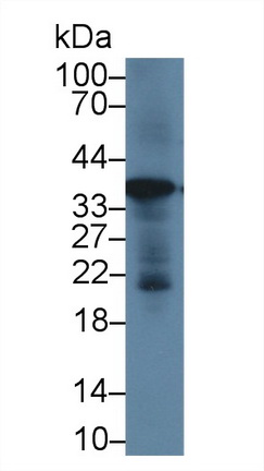 14711