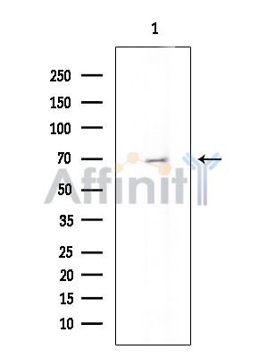 Валидация Affinity DF15526 - 11910