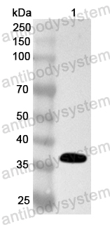 Валидация AntibodySystem PHA61601
