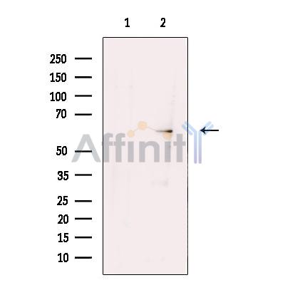 Валидация Affinity DF13348 - 8551