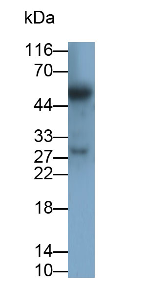 30925