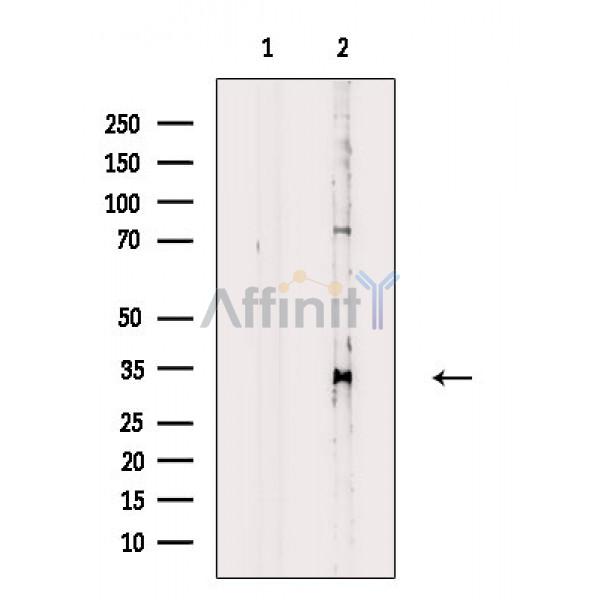 Валидация Affinity DF6592 - 18034