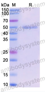 Валидация SDS-PAGE - AntibodySystem DHB86921