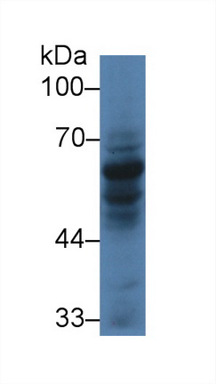 14266