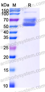 AHD14202, SDS-PAGE