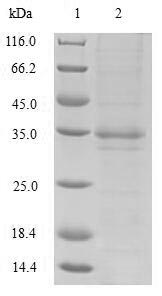 SDS-PAGE