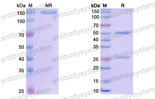 Валидация SDS-PAGE - AntibodySystem DHE16604