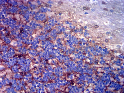 Валидация AntibodySystem RHD08703 (1326)