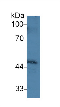 14255