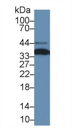 14896