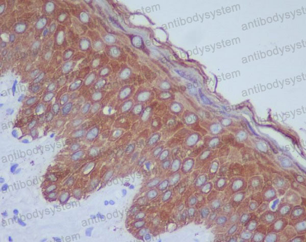 Валидация AntibodySystem RHB98002