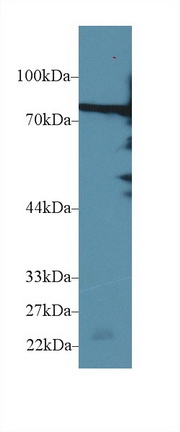 14594
