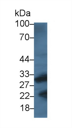14844
