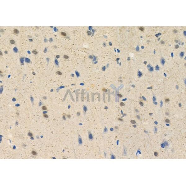 Валидация Affinity DF3155 - 13952