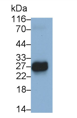 28415