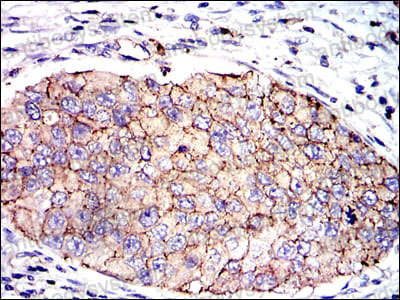 Валидация AntibodySystem RHC13909 (665)