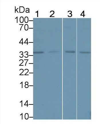 11087