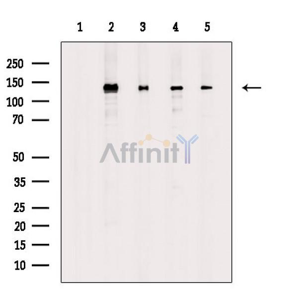 Валидация Affinity DF8061 - 19891