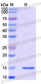 Валидация SDS-PAGE - AntibodySystem RWN10302