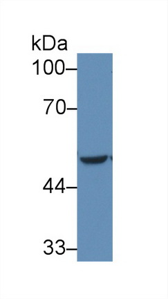 14914